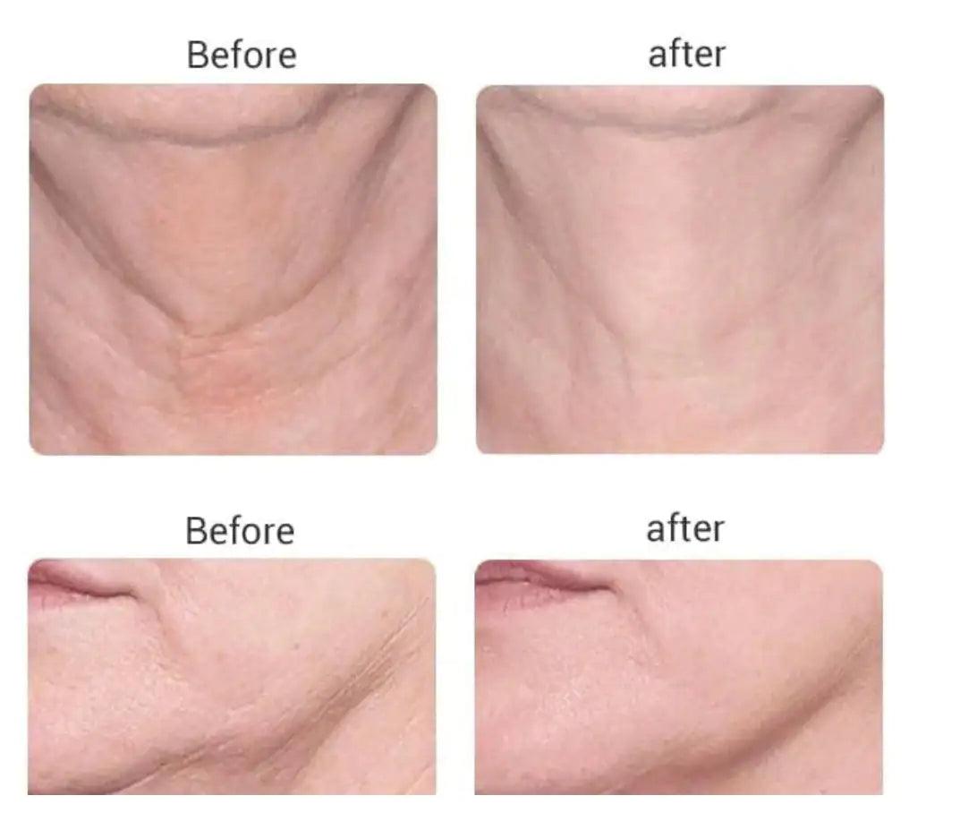 Youthful Skin with Microcurrent Facial Toning - Sí Fashions