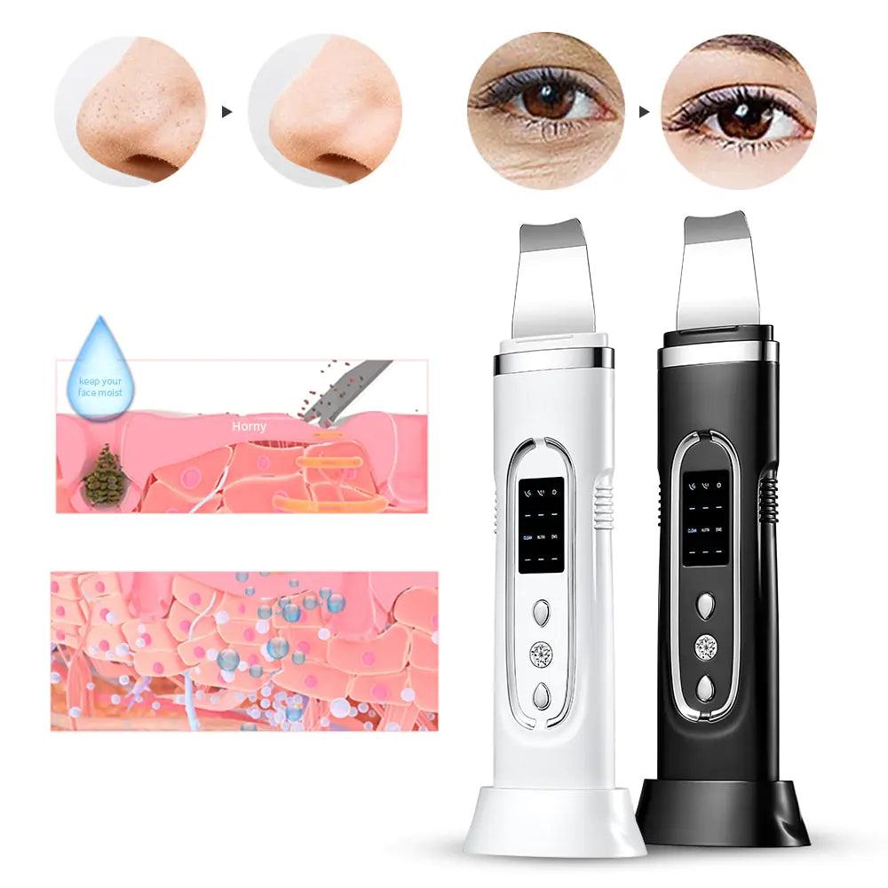 Ultrasonic Blackhead Removal