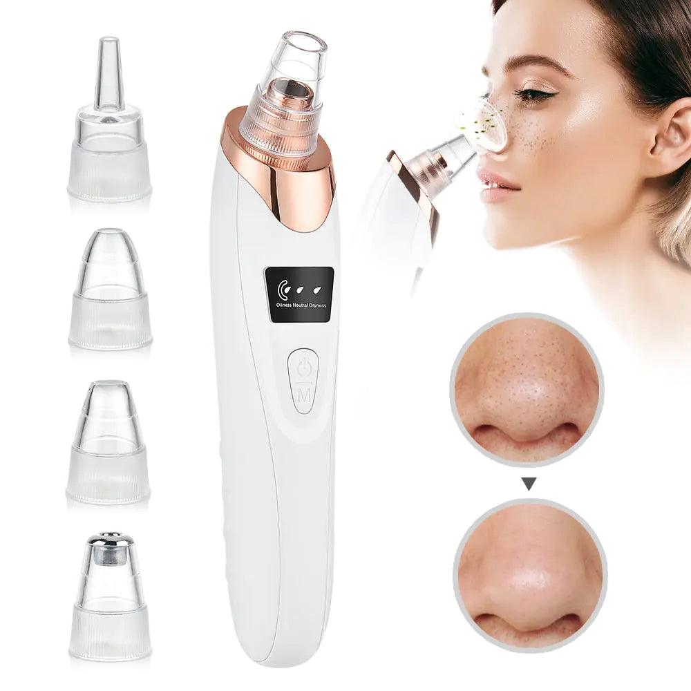 Beauty Electric Blackhead Remover - Sí Fashions