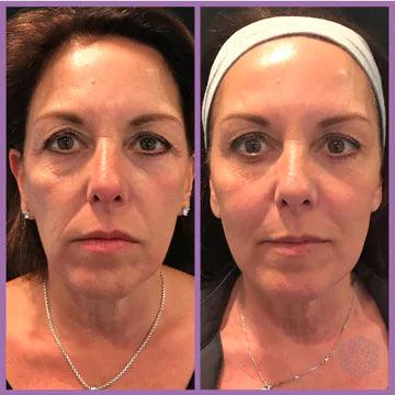 Youthful Skin with Microcurrent Facial Toning - Sí Fashions