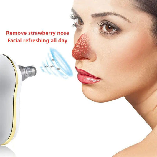 Vacuum Suction Beauty Machine - Deep Cleansing - Sí Fashions