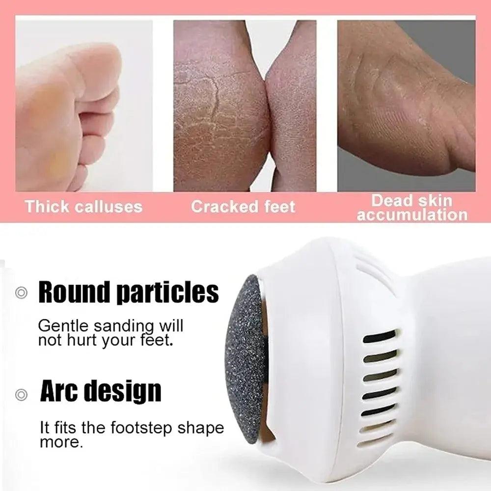 Electric Callus Remover and Heel Grinding - Sí Fashions